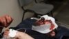Armenia -- Argishti Kivirian, editor of "Armenia Today" news agency beaten on 30Apr2009. Photo courtesy of Gagik Shamshian